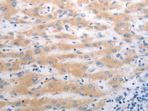 PAK1 Polyclonal Antibody Store at -20°C