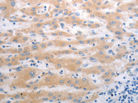 PAK1 Polyclonal Antibody Store at -20°C