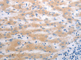 PAK1 Polyclonal Antibody Store at -20°C