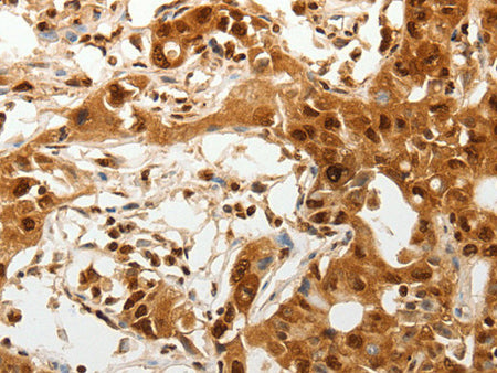 TENM3 Polyclonal Antibody Store at -20°C