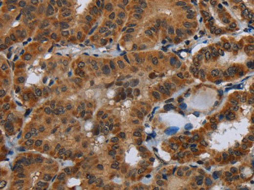 Glucocorticoid Receptor Polyclonal Antibody Store at -20°C