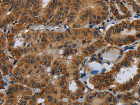 Glucocorticoid Receptor Polyclonal Antibody Store at -20°C