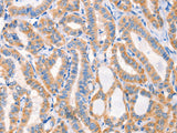 Factor XIIIa Polyclonal Antibody Store at -20°C