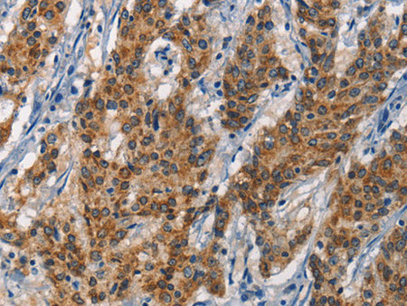 APOL1 Polyclonal Antibody Store at -20°C