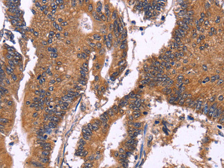 SEPT7 Polyclonal Antibody Store at -20°C