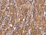 FBXO31 Polyclonal Antibody Store at -20°C