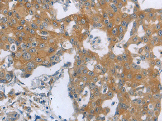 TNK2 Polyclonal Antibody Store at -20°C