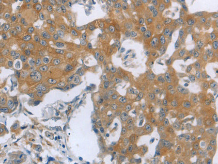 TNK2 Polyclonal Antibody Store at -20°C