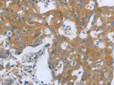 TNK2 Polyclonal Antibody Store at -20°C