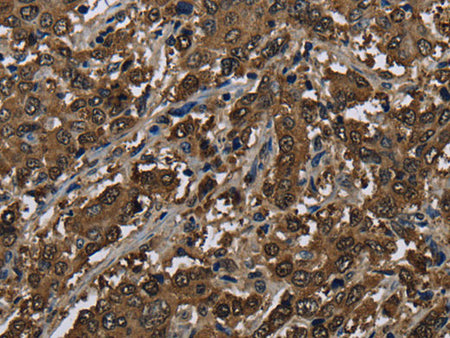 GSTP1 Polyclonal Antibody Store at -20°C