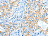 COL4A2 Polyclonal Antibody