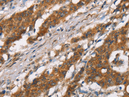 DSC2 Polyclonal Antibody Store at -20°C