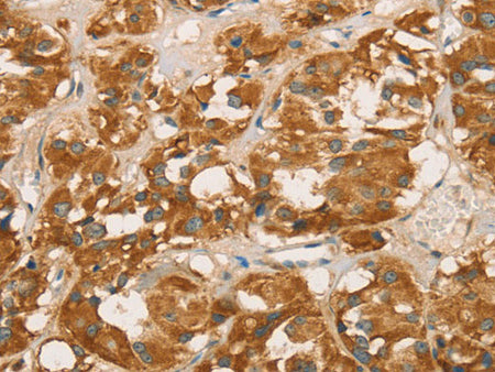 RBBP8 Polyclonal Antibody Store at -20°C