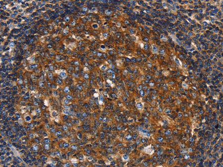 GNA13 Polyclonal Antibody Store at -20°C