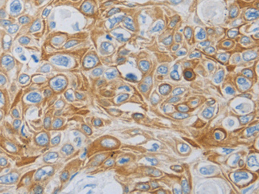 MC5R Polyclonal Antibody Store at -20°C