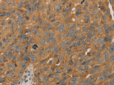 PARP11 Polyclonal Antibody