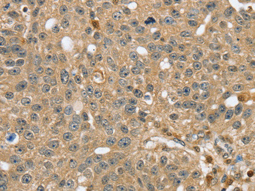 RNH1 Polyclonal Antibody Store at -20°C