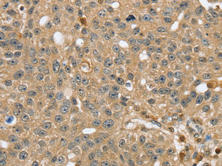 RNH1 Polyclonal Antibody Store at -20°C