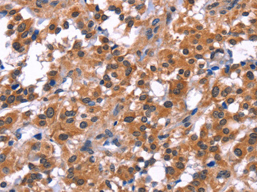 PIP5K1B Polyclonal Antibody Store at -20°C