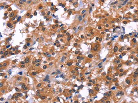 PIP5K1B Polyclonal Antibody Store at -20°C
