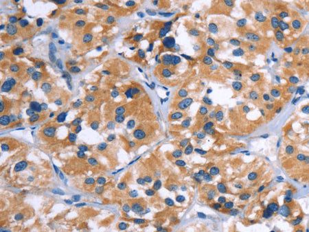COMP Polyclonal Antibody Store at -20°C