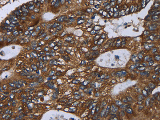 GOLGA2 Polyclonal Antibody Store at -20°C