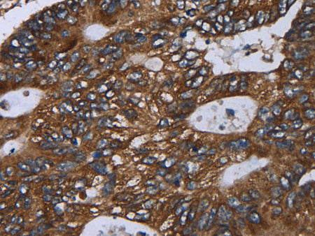 GOLGA2 Polyclonal Antibody Store at -20°C