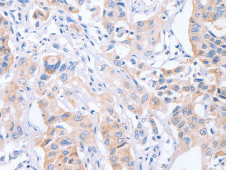 CDCA4 Polyclonal Antibody Store at -20°C