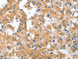 CDR2 Polyclonal Antibody
