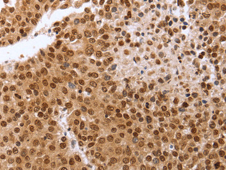 PTTG1 Polyclonal Antibody Store at -20°C