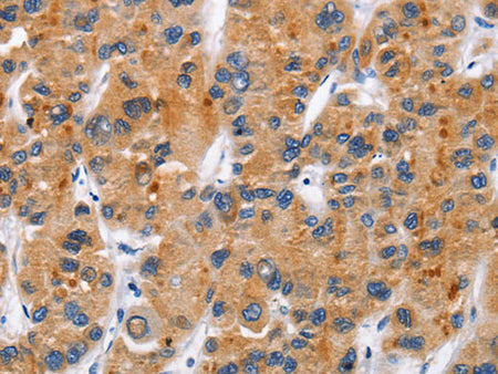 CD137 Polyclonal Antibody Store at -20°C