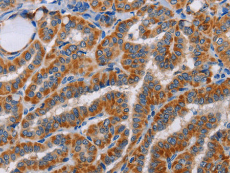 ALG9 Polyclonal Antibody Store at -20°C