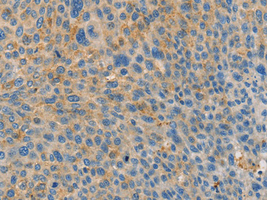 BRCA1 Polyclonal Antibody Store at -20°C - MSE Supplies LLC