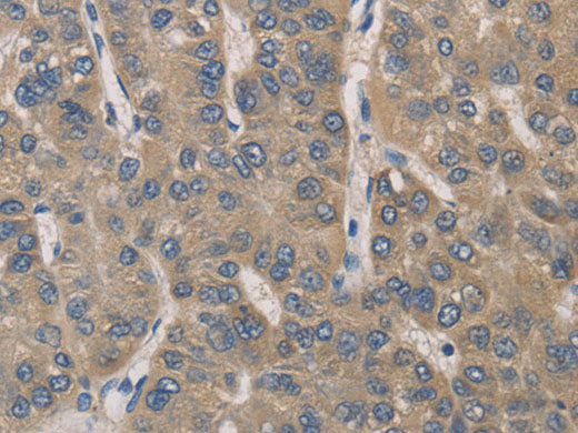 IRAK4 Polyclonal Antibody Store at -20°C