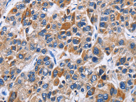 ENPP5 Polyclonal Antibody Store at -20°C