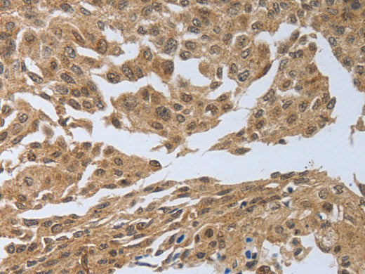 PSMD6 Polyclonal Antibody Store at -20°C