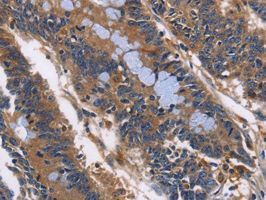 ILK Polyclonal Antibody Store at -20°C