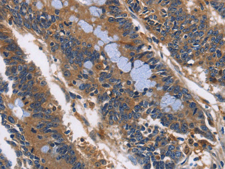 ILK Polyclonal Antibody Store at -20°C