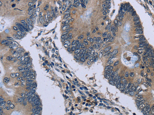 Connexin 47 Polyclonal Antibody Store at -20°C