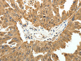 PTCH1 Polyclonal Antibody Reactivity Human, Mouse