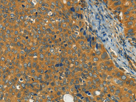 KLC1 Polyclonal Antibody Store at -20°C