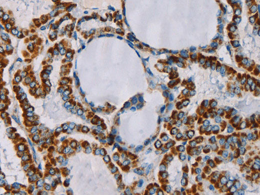 MTF2 Polyclonal Antibody Store at -20°C