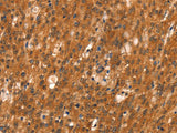 DAB2IP Polyclonal Antibody
