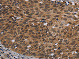 CEBPD Polyclonal Antibody
