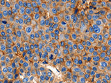 Claudin 1 Polyclonal Antibody Store at -20°C