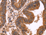 ERP29 Polyclonal Antibody