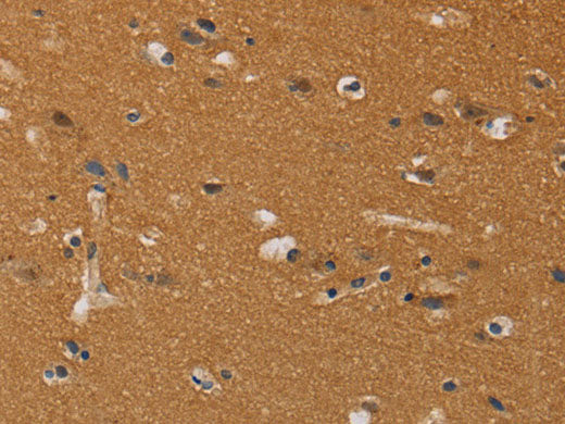 CHRNA4 Polyclonal Antibody Store at -20°C