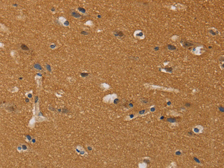 CHRNA4 Polyclonal Antibody Store at -20°C