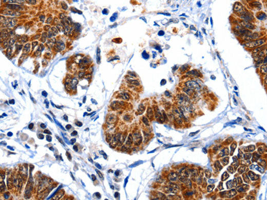 GSK3 alpha Polyclonal Antibody Store at -20°C