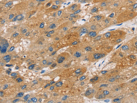 ST18 Polyclonal Antibody Store at -20°C
